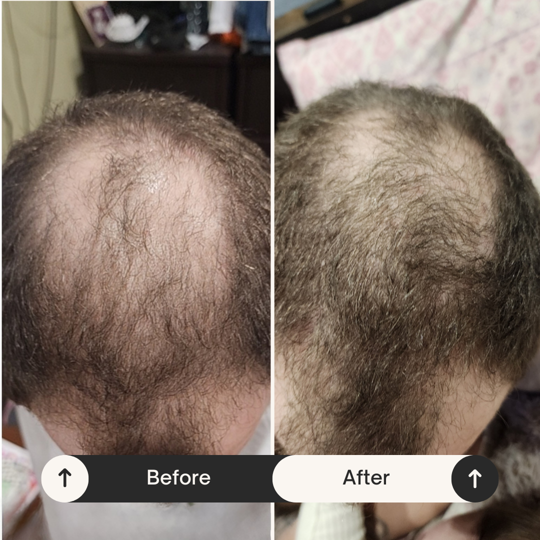 Easy Rider Mens Hair Regrowth Shampoo | Mens Hair Loss Treatment Shampoo Made in New Zealand