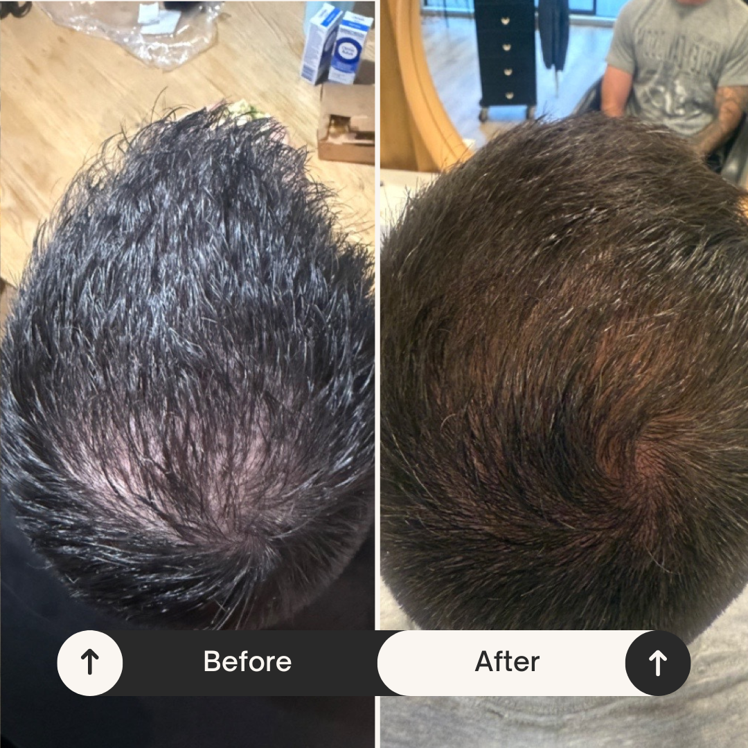Guitar Hair-O Mens Regrowth Spray | Mens Hair Loss Treatment Spray Made in New Zealand